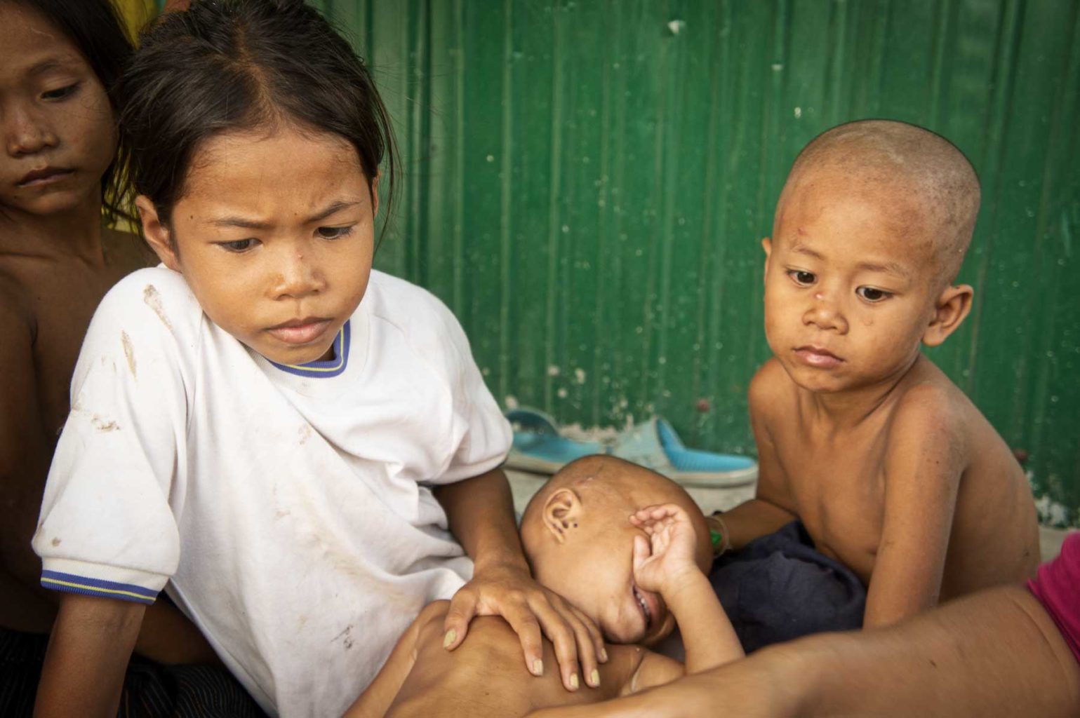 Petit garçon dans une grande souffrance localisé par nos volontaires au Cambodge. Dans les cas les plus difficiles, nous accueillons les enfants dans notre centre de protection de l’enfance de Battambang