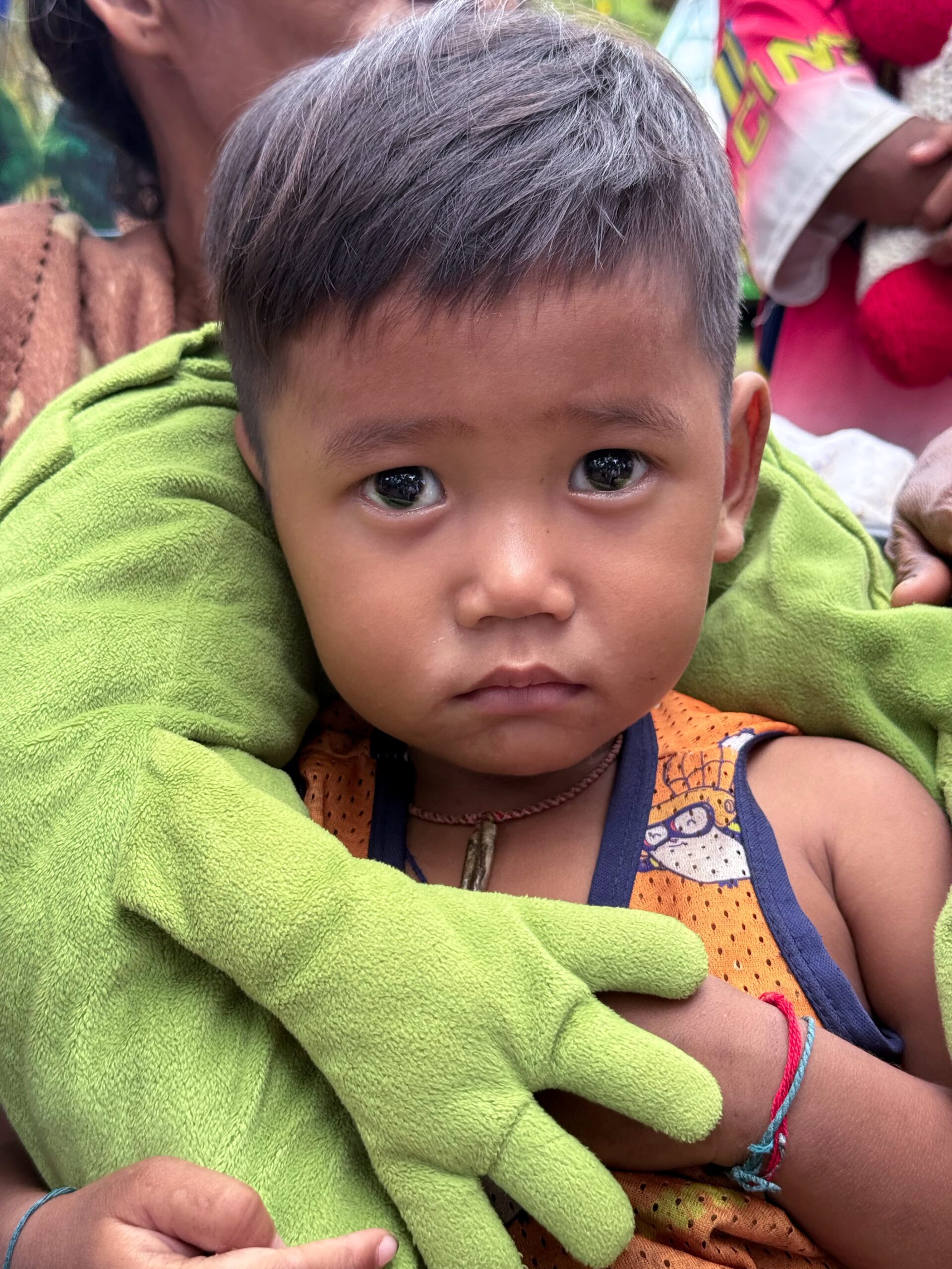 Petit garçon cambodgien ayant fuit les bombes Thai dans un camp de réfugiés 2025